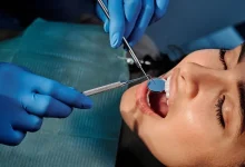 Top Signs You Need to Get Your Gums Checked Tips from Experts