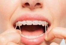 Common Orthodontic Concerns for Adults Causes Symptoms and Solutions