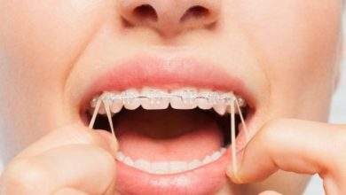 Common Orthodontic Concerns for Adults Causes Symptoms and Solutions
