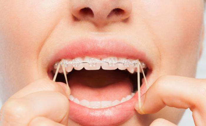Common Orthodontic Concerns for Adults Causes Symptoms and Solutions