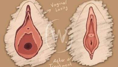 vagilangelo solution for post delivery laxity