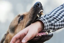 What Damages Can You Claim After a Dog Bite